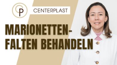 Marionettenfalten behandeln