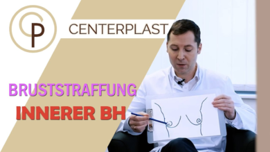 Vorschaubild zu Bruststraffung mit innerem BH