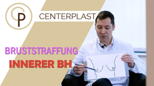 Vorschaubild zu Bruststraffung mit innerem BH